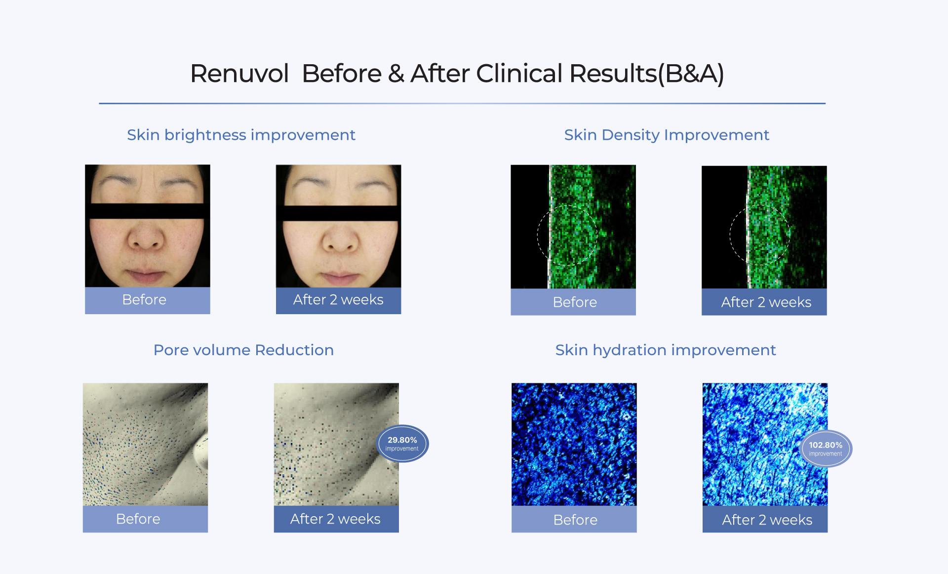 RENUVOL background visual